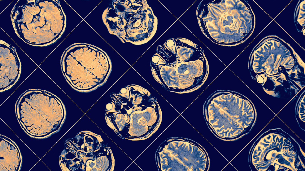 A Image of a brain scam